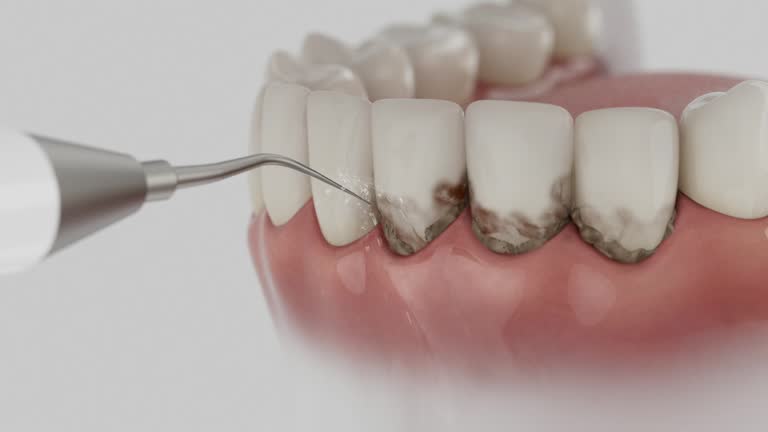 Reliable Dental Implants contractor in Delmar, MD by Smile Center Dentistry